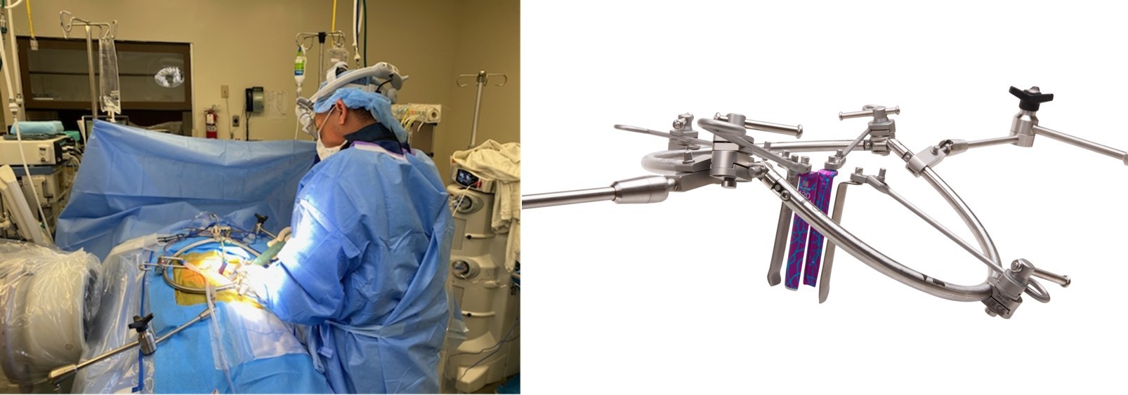 Écarteur lombaire - Phantom XL3™ - TeDan Surgical Innovations