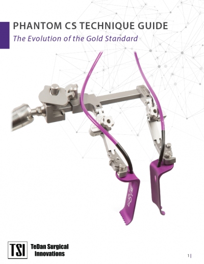 Phantom CS Classic System - Tedan Surgical Innovations